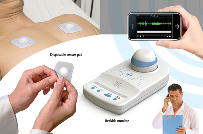 Medical device design of a wireless pulmonary monitor.